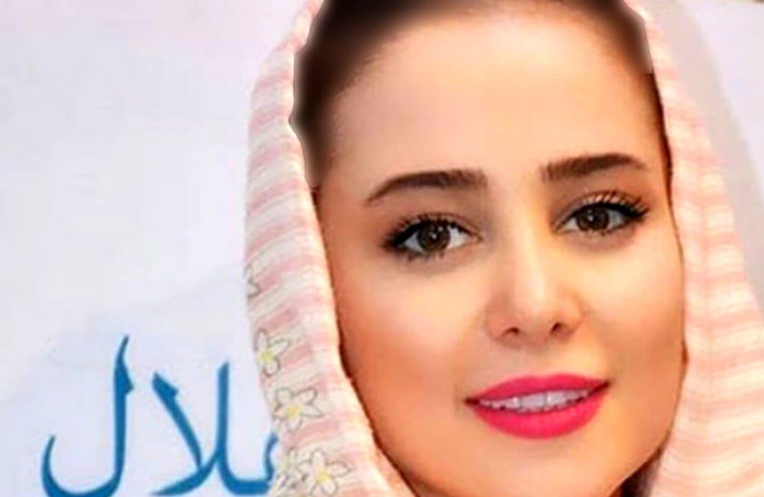فیلم تغییر چهره فوق دردناک الناز حبیبی/ دختر کوچولوی سینما به چه روزی افتاد؟!