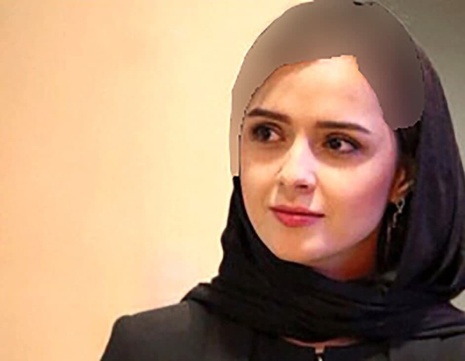 ترانه علیدوستی در ۲۰ سالگی چه شکلی بود؟ + عکس