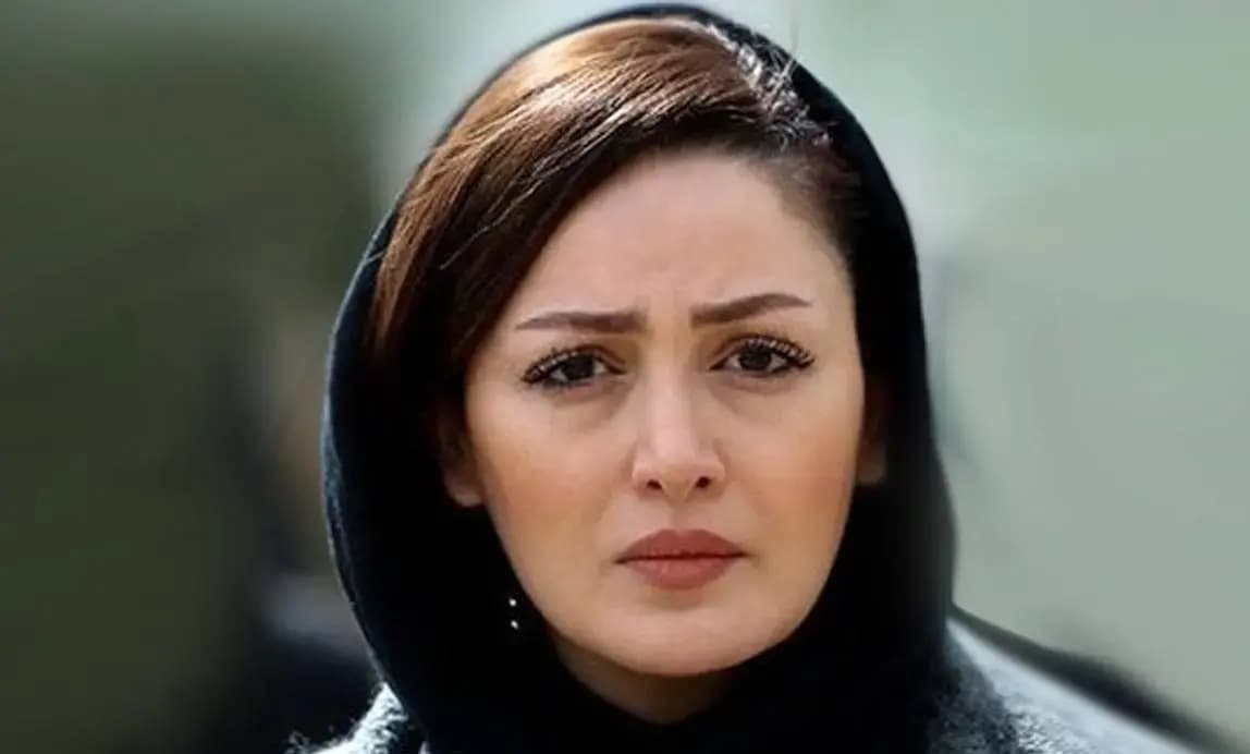 عکسی دیده نشده از چهره شیلا خداداد قبل از عمل / شیلا خداداد کوبیده از نو ساخته