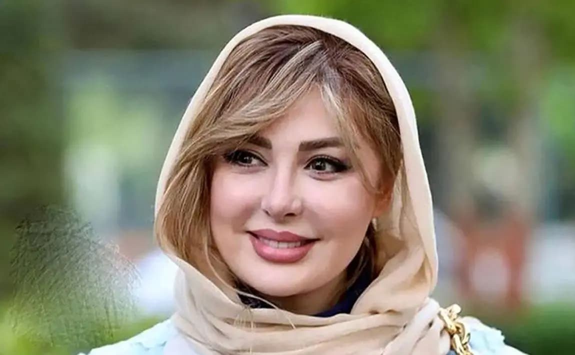 تغیر چهره حیرت آور نیوشا ضیغمی در جدید ترین عکس / خانم بازیگر معتاد عمل های زیبایی شده است !
