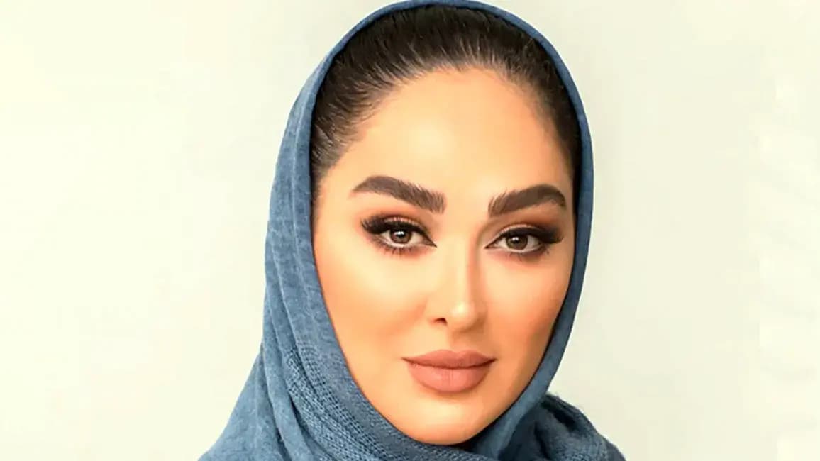 الهام حمیدی  در گذر زمان / تغییر چهره الهام حمیدی  همه را شگفت زده کرد