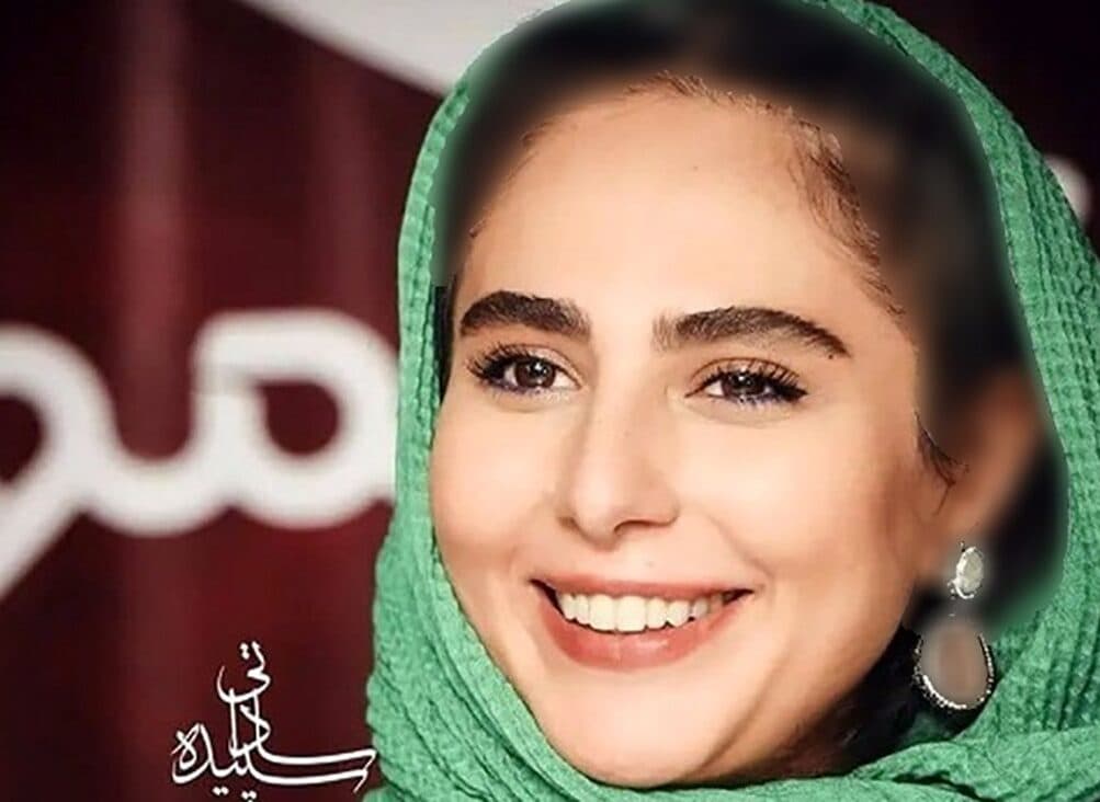 تغییرات رعنا آزادی ور از مارمولک تا زخم کاری / خانم بازیگر معصومیتش را از دست داد !