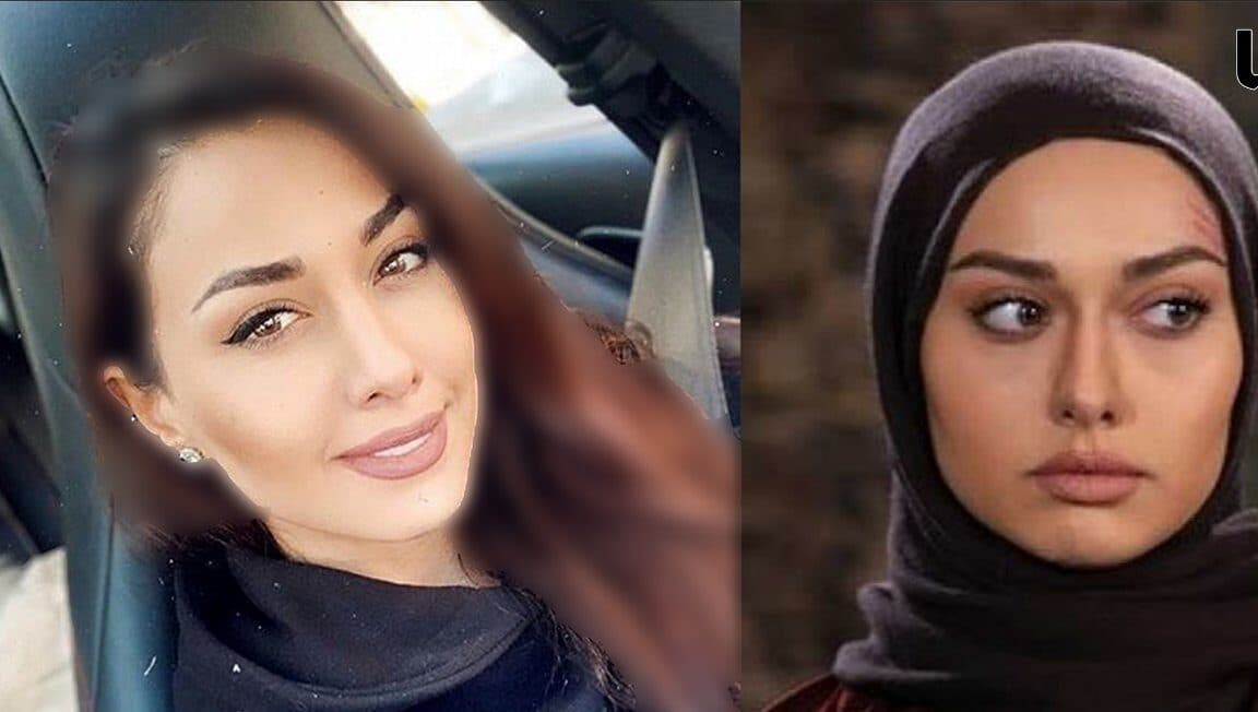 فیلم / ریز به ریز عمل های زیبایی صدف طاهریان ! / تغییر زمین تا آسمون خانم بازیگر در خارج !