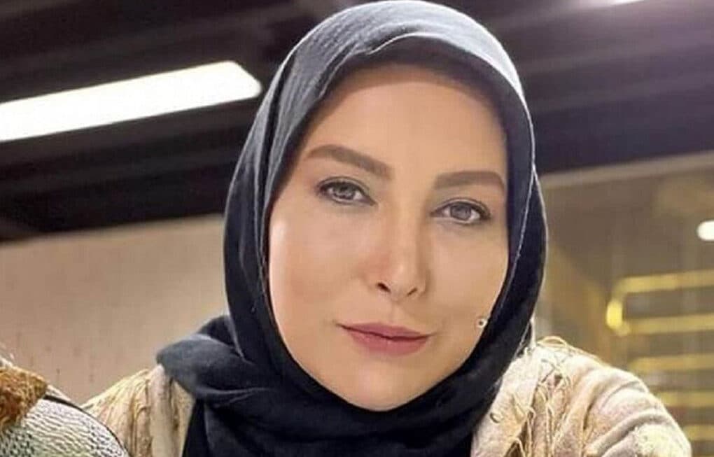 زیبایی فریبا نادری بعد از آخرین عمل جراحی پلاستیک ! / خانم بازیگر ستایش رخ نمایی کرد !