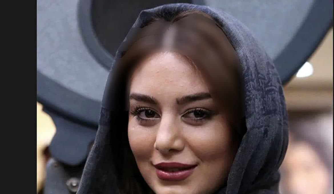 عکس منتشر شده از زایمان سحر قریشی در بیمارستان داخل ایران + عکس های تغییرات چهره خانم بازیگر !