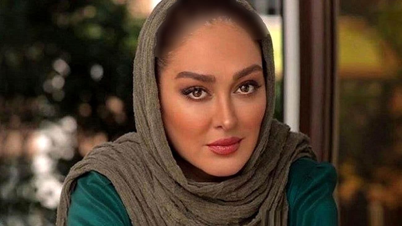 تغییرات زیبای همه صورت الهام حمیدی / ببینید چی بود و فوق جذاب شد ! + 9 عکس حیرت انگیز !