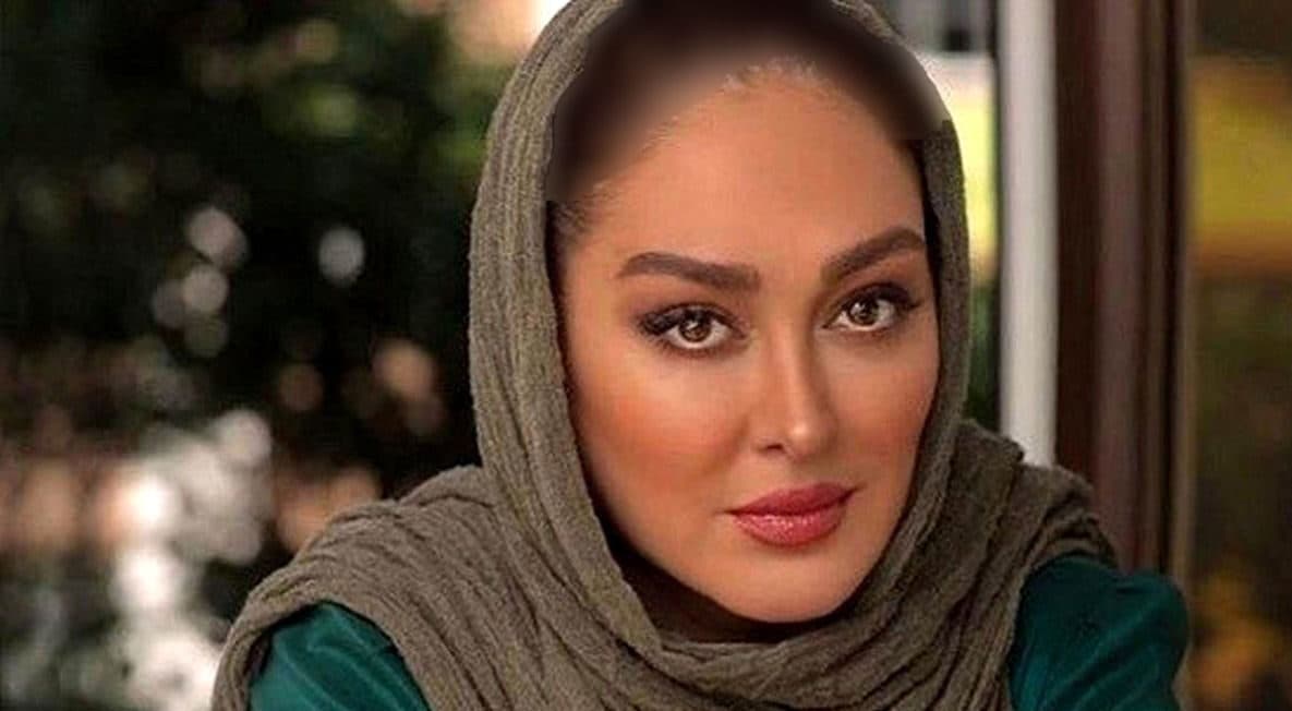 تغییرات همه صورت الهام حمیدی / شوکه کننده اما فوق جذاب! + 9 عکس بلوا کننده و هوش پران!