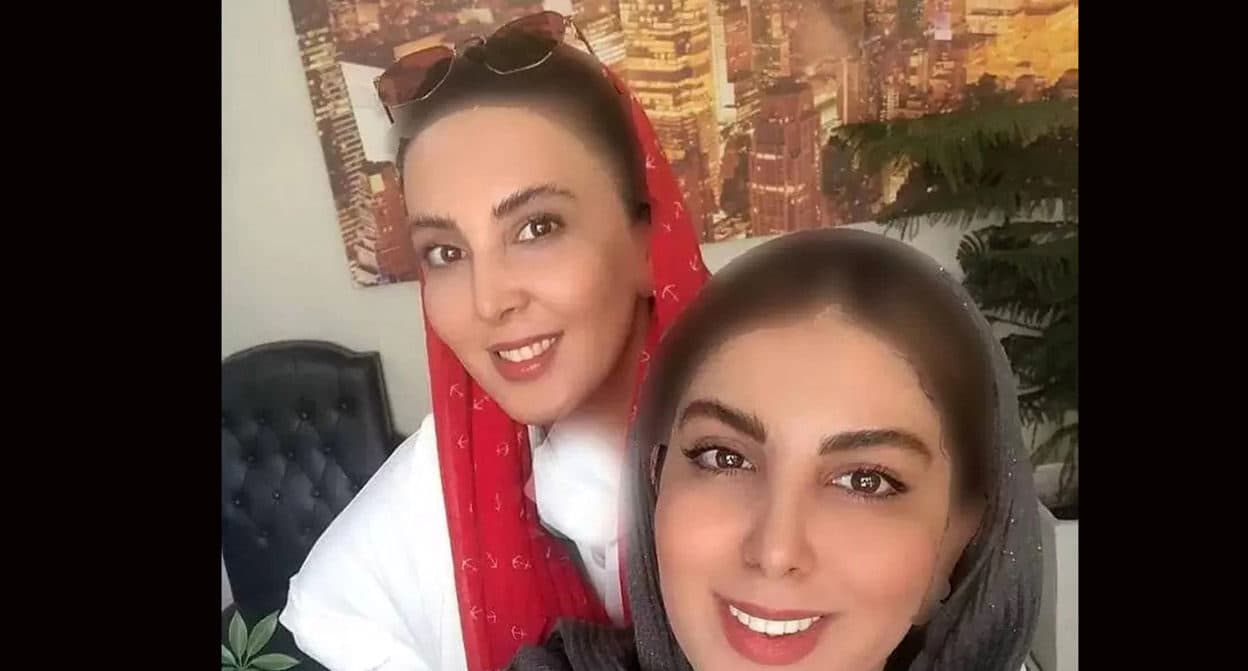 تغییر چهره خواهر لیلا بلوکات پس از مدت ها / زیبایی اش دوبرابر شده ! + عکس