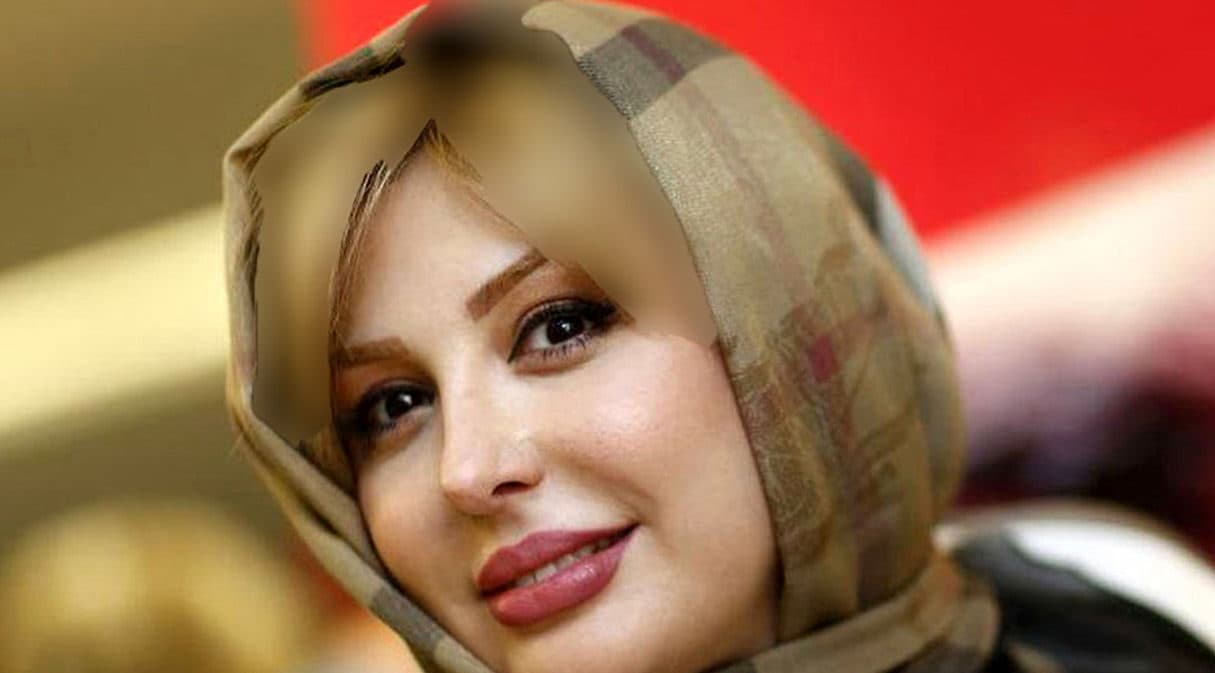 چهره متفاوت نیوشا ضیغمی قبل از عمل جراحی / امکان ندارد نیوشا ضیغمی را در این عکس بشناسید