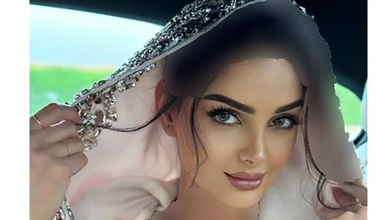 تغییر چهره و بینی بزرگ مه لقا جابری قبل از عمل / رابطه عاشقانه با بازیگر ترک؟!