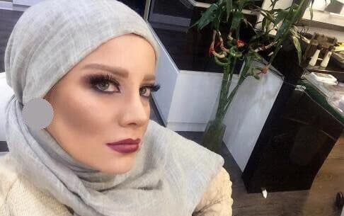 شراره رخام: تزریق ژل لب باعث بیکاریم شد؛ با کمک یه پزشک خوب این ژل رو تخلیه کردم