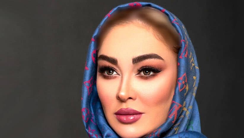 الهام حمیدی: مجبورم با سیلی صورتم را سرخ نگه دارم می خواهم چهره ام طبیعی باشد تا تا یک چهره عمل شده تغییر یافته ! + فیلم