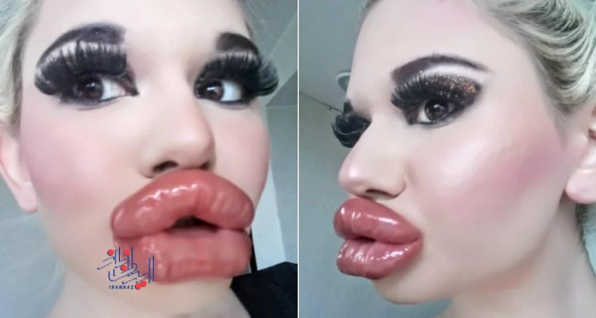 «این زن رکورد بزرگترین لب و گونه جهان را شکست! 😱 عکس‌های عجیب و غریبش را ببینید»