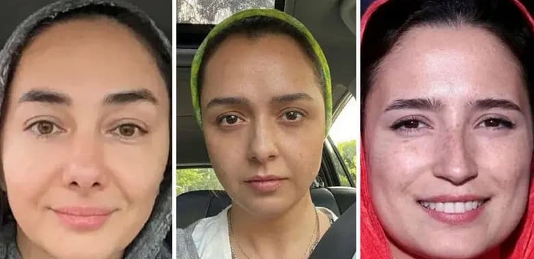 حیرت‌آور! بازیگرانی که بدون جراحی هم زیباترین هستند + عکس