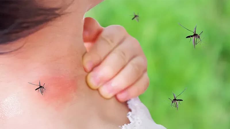 آیا کودکتان را حشره گزیده؟ علائم خطرناک را بشناسید