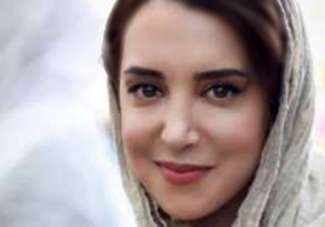 تغییر چهره سحر جعفری جوزانی با جراحی زیبایی ! / قرار بود عروسکی شود زشت شد !